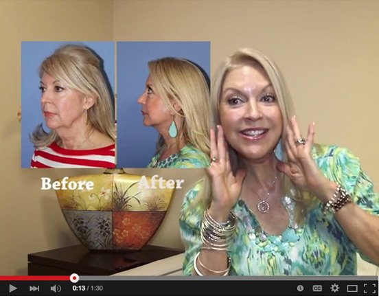 Plastic Surgery Patient Video Testimonials